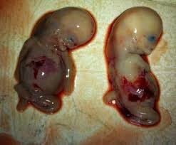 Image result for depleted+uranium+babies