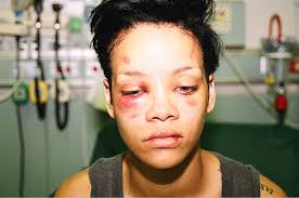Resultado de imagen de fotos de rihanna maltratada
