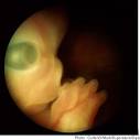 Evolution du foetus - semaine par semaine - Doctissimo