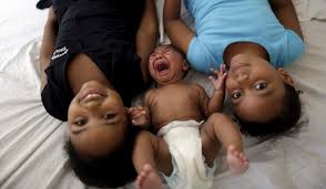 Image result for images of zika babies