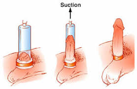 Vakum Pembesar penis , Alat Pembesar Penis , obat pembesar penis ,alat vakum big long permanen Images?q=tbn:ANd9GcQN_dnebOE6-nuorfXsYTQVKFQ2-bvwQxBd5lnqYBxaZlxLLX7K