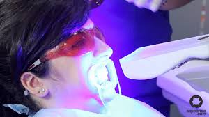Resultado de imagen para Blanqueamiento dental por luz fría y láser  EN ODONTOLOGIA