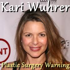 Actress Kari Wuhrer explained why she decided to remove her breast implants and how she maintains positive body image in Hollywood on The Doctors. - Kari-Wuhrer-Plastic-Surgery-Warning1