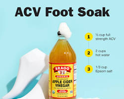 Image of Apple Cider Vinegar for Athlete's Foot