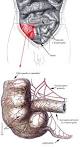 Inflammation and tissue pathology in the caecum following chronic