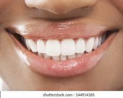 Image of close up photo of woman smiling with perfect white teeth