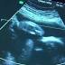 Gov. John Kasich vetoes Heartbeat Bill, signs 20-week abortion ban