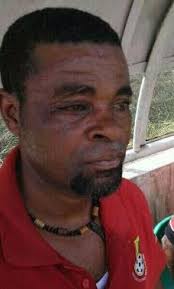 Fans of Berekum Arsenals are alleged to have assaulted Unity FC coach Nana Andy Sinason before their second tier league match on Saturday. - Assaulted-coach-Nana-Andy-Sinason