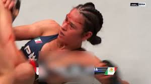 MMA star suffers wardrobe malfunction during KO - Toowoomba Chronicle