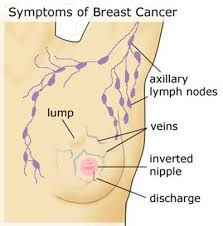 Image result for breast cancer and its causes