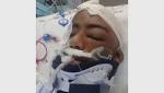 traumatised son's injuries