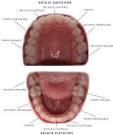 Capsulotomia yag laser