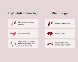 صورة implantation bleeding during pregnancy