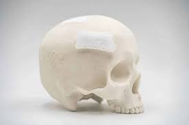 The state of bioprinting