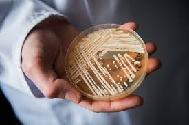 What to know about Candida auris, a fungus contaminating healthcare spaces