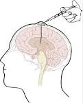 Gehirn: Zentralnervensystem, Hirnhaut, Hypothalamus. 