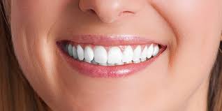 Image result for dental implants