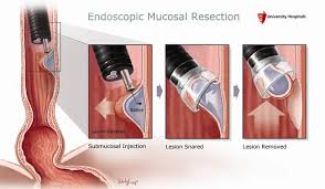 英和画像辞典：(mucosal)の関連画像一覧！ – おもしろい英文法