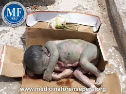 Resultado de imagen para tanatologia forense