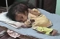 Image result for depleted+uranium+babies