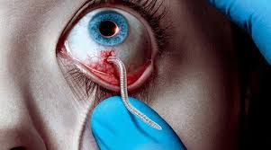 Kuvahaun tulos haulle the strain