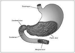 Image result for human stomach