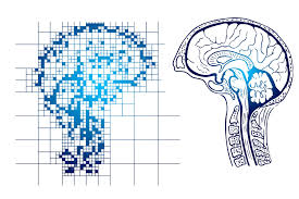 Algorithm to Predict Alzheimer's Risk across Diverse Ethnical Groups: A Breakthrough in Research - 1