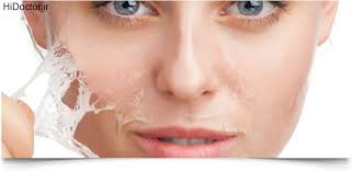 تصویر مرتبط