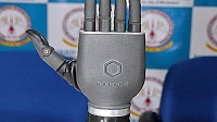 TTD-run hospital rolls out first ‘bionic hand’