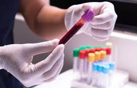 “Revolutionary  Blood Test Enabling Early Detection of Multiple Cancers”