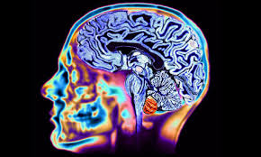 Image result for impact of video gaming on the brain