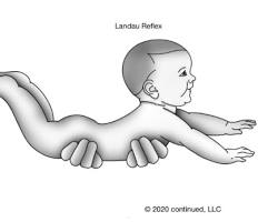 Landau reflex 이미지