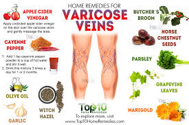 Image result for Varicose veins