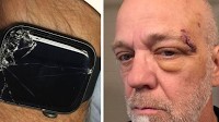 Apple Watch saves life: Washington man credits Apple Watch's fall detection feature for saving father after falling