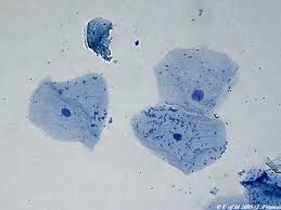 external image images?q=tbn:ANd9GcQmZvBBruue4bemW0rSCvx25y0_CpGiLowUnNkC1IygshZWLlx5