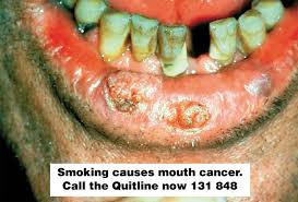 Image result for images of tobacco