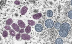 Caso de Mpox é confirmado em Porto Alegre