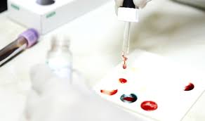 The Promising Israeli Breakthrough: A Groundbreaking Blood Test that Detects Bipolar Disorder - 5