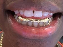 Image result for teeth grillz