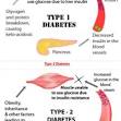 Diabetes: The Difference Between Type 1 and Type 2 Diabetes