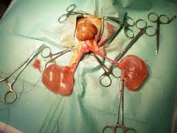 Znalezione obrazy dla zapytania Cysta