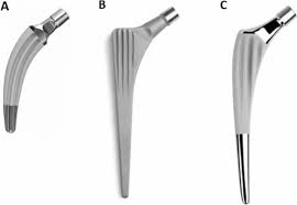 Biomechanical analysis of different THA cementless femoral ...