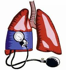 Resultado de imagem para HIPERTENSÃO ARTERIAL PULMONAR