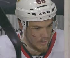 Andrew Shaw face stitches. GIF via Guyism - andrew-shaw-stitches