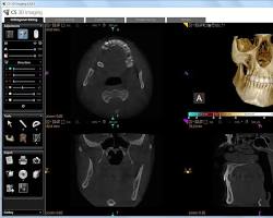 Image of Carestream Dental imaging software