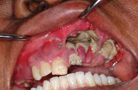 Résultat de recherche d'images pour "krokodil"