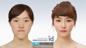Image result for jaw surgery