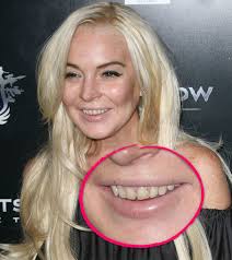 Lindsay Lohans Zähne lassen zu wünschen übrig. Bildquelle: Adriana M. Barraza / WENN - lindsay-lohans-zaehne-lassen-zu-wuenschen-uebrig
