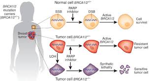 Image result for ‫۲۰ مورد مشکوک به سرطان در بانوان‬‎