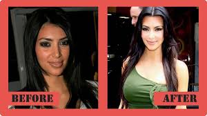 Résultat de recherche d'images pour "who is kim kardashian before and after"